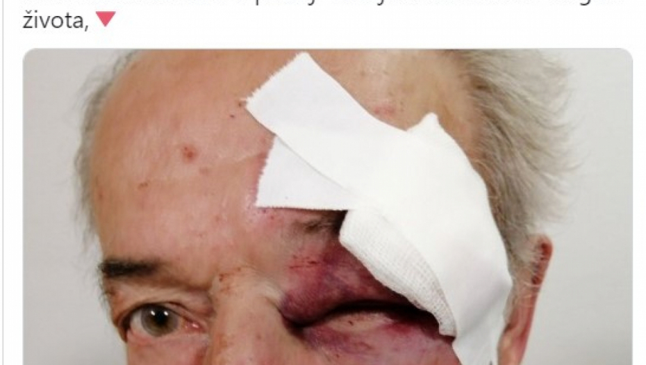 SASLUŠAN NAPADAČ KOJI JE BRUTALNO PRETUKAO GENERALA U PENZIJI Evo kako se branio pred tužilaštvom!