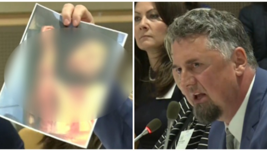OVO JE MOJA BABA KOJOJ SU OTKINULI GRKLJAN Srbin pokazao slike koje gleda ceo svet - on je preživeo horor u BiH (UZNEMIRUJUĆE FOTOGRAFIJE)