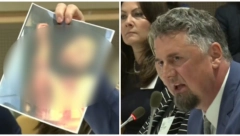 OVO JE MOJA BABA KOJOJ SU OTKINULI GRKLJAN Srbin pokazao slike koje gleda ceo svet - on je preživeo horor u BiH (UZNEMIRUJUĆE FOTOGRAFIJE)