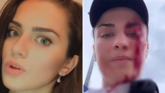 UZNEMIRUJUĆI SNIMAK Lepa bokserka brutalno pretučena ZBOG ŠORCA?! Jedva je izvukla živu glavu (VIDEO)