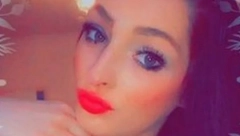DEVOJKA (24) JE PREŽIVELA PAKAO Sve je počelo od žulja na stopalu, na kraju su joj odsekli nogu!