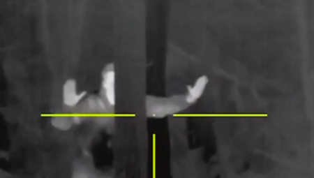 UZBUNA U KIJEVU Pet ranjeno u napadu na Zaporožje (FOTO/VIDEO)