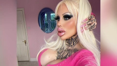 IZOBLIČILA SE DO NEPREPOZNATLJIVOSTI Dala čitavo bogatstvo plastičnom hirurgu da bi izgledala OVAKO (FOTO)