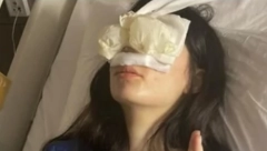 NISAM MOGLA SAMA DA USTANEM IZ KREVETA Našoj influenserki (23) lice prekriveno flasterima, poznato šta se desilo