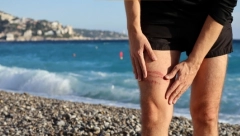 OŽARILA VAS JE MEDUZA? Evo šta nikako ne smete da radite, a svi prave jednu kardinalnu grešku! Ovo će vam olakšati bol