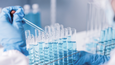NOVI TEST ZA OTKRIVANJE TEŠKE BOLESTI Tačan gotovo stoprocentno