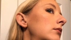 OTKRILA 20 TUMORA U SVOM TELU NAKON MASAŽE LICA Stigla joj najgora vest, a evo kako se spasila sigurne smrti