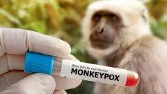 NEMCI U PANICI! Otkriven prvi slučaj majmunskih boginja!