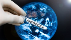 KAKO POTENCIJALNO PROGLAŠENJE PANDEMIJE MAJMUNSKIH BOGINJA MOŽE UTICATI NA MENTALNO ZDRAVLJE? Psihološkinja Anita upozorila na probleme, dala vredan savet