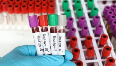 "ĐACI SE VRAĆAJU U ŠKOLU, RODITELJI IMAJU OBAVEZE, A REZERVE KRVI SVE MANJE!" Institut za transfuziju pozvao građane DA POMOGNU!