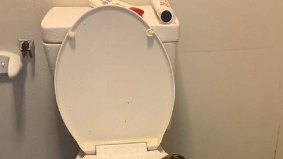 SEO NA WC ŠOLJU, PA OSETIO STRAVIČAN BOL Opasno stvorenje ga zgrabilo za međunožje, uzeo četku za kosu pa krenuo da udara - krv lipti na sve strane!