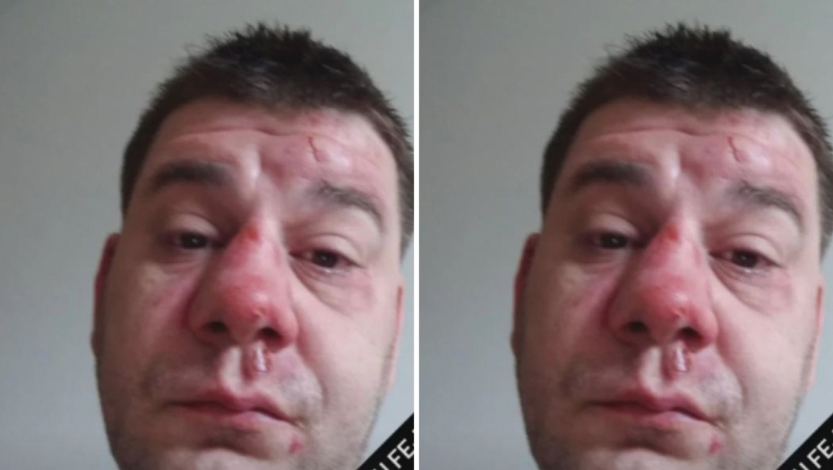 IVAN MARINKOVIĆ IZGREBAN I PRETUČEN! Pojavila se jeziva fotografija: "Drogiranog te šamara ko kako stigne"