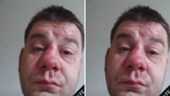 IVAN MARINKOVIĆ IZGREBAN I PRETUČEN! Pojavila se jeziva fotografija: "Drogiranog te šamara ko kako stigne"