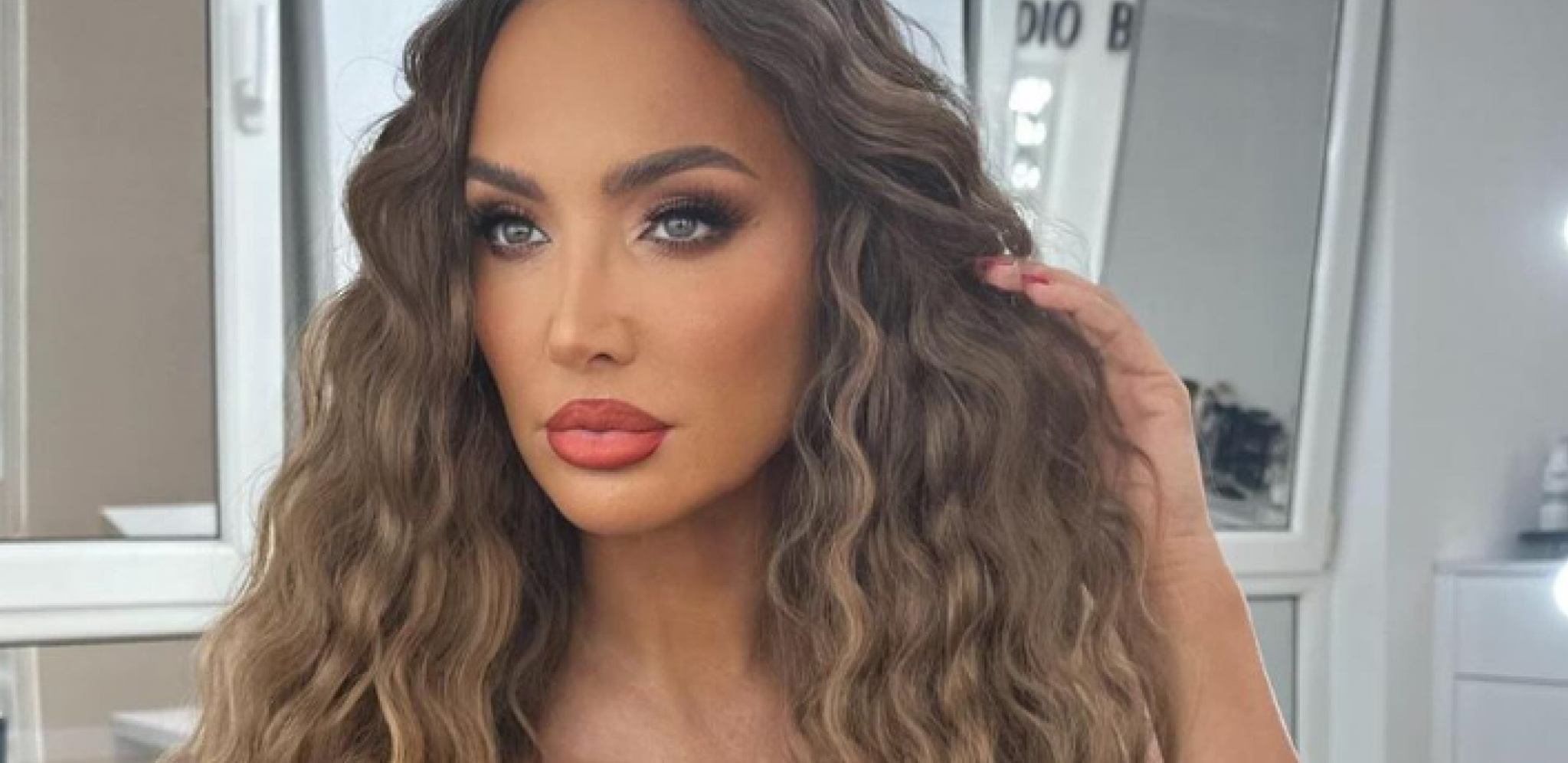 "JAUKALA JE OD BOLOVA" Žena očevidac otkrila detalje nezgode u kojoj je povređena Goga Sekulić