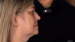 SA 52 GODINE, LANA JE ŽELELA DA PONOVO IZGLEDA KAO SA 18 Hirurgu je donela jednu jedinu fotografiju. Pogledajte njen novi izgled (UZNEMIRAVAJUĆI VIDEO)