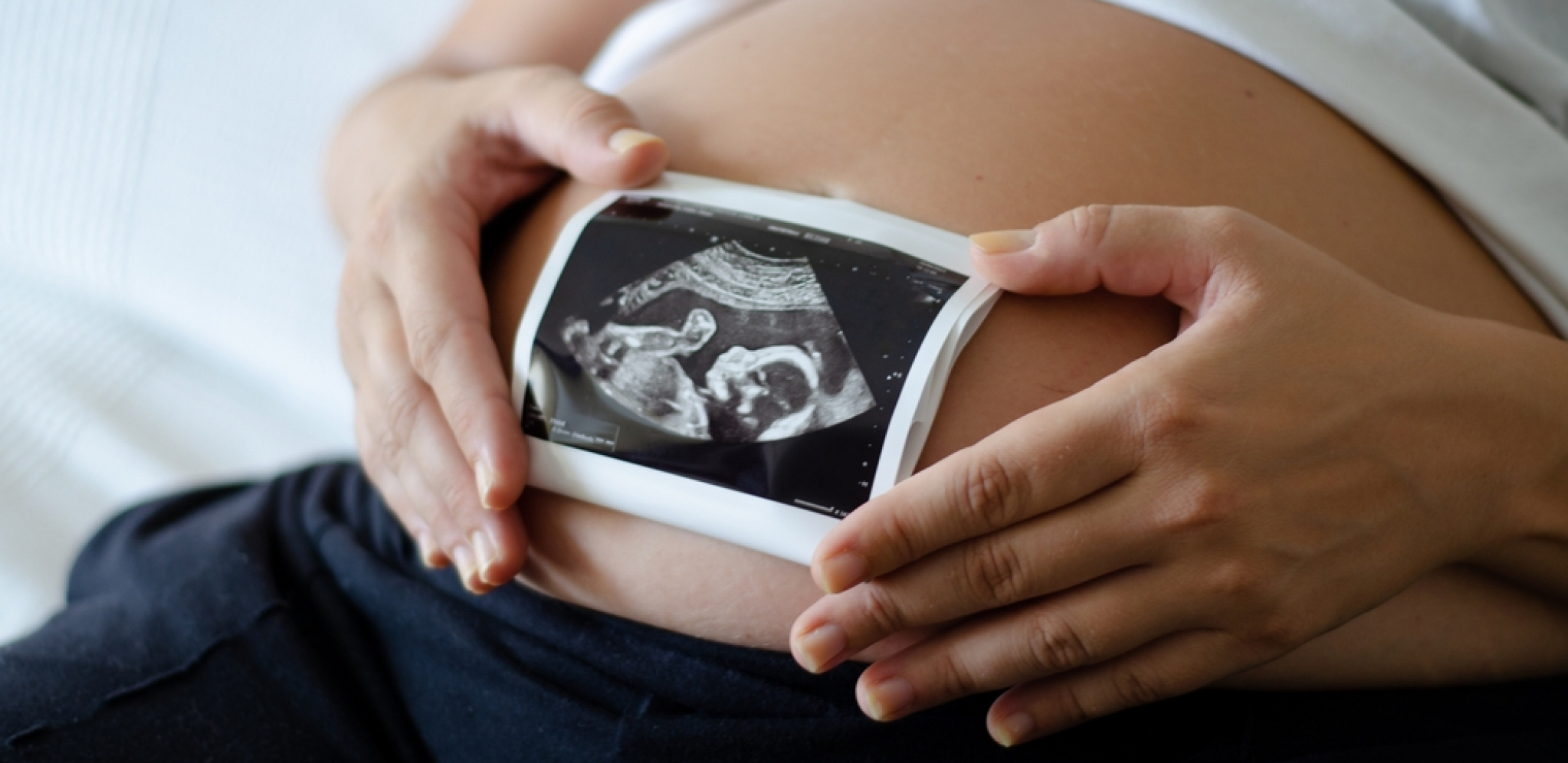 BEBI-BUM U LOZNICI! Rođeno 30 beba za osam dana!