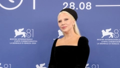 OMALOVAŽAVALI SU JE I IZGOVARALI NAJGORE UVREDE U detinjstvu preživela vršnjačko nasilje, a danas je Stefani ogromna zvezda