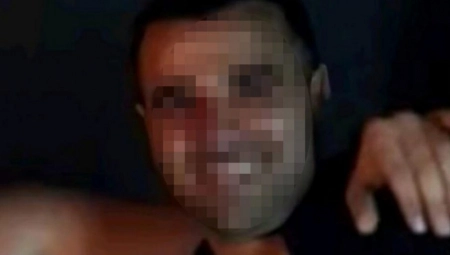 "PLAŠIM SE ZA SVOJ ŽIVOT": Oglasila se devojka koja je pretučena u novobeogradskom restoranu
