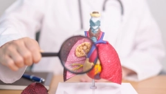 NAPRAVLJEN EPOHALNI UREĐAJ Brza i neinvazivna dijagnostika kancera