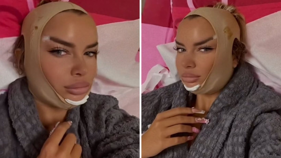 BIVŠA ZADRUGARKA SVA U ZAVOJIMA! Isplivao snimak nakon operacije: "Izobličila si se"