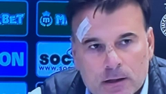 POGOĐEN ALEKSANDAR STANOJEVIĆ Ovako izgleda trener Partizana nakon skandala u Humskoj