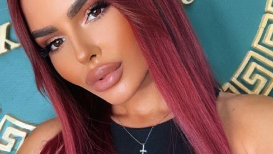 EVO KAKO ANITA IZGLEDA NAKON OPERACIJE! Stanojlovićeva skinula zavoje sa lica, ne liči na sebe! (FOTO)