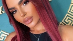 EVO KAKO ANITA IZGLEDA NAKON OPERACIJE! Stanojlovićeva skinula zavoje sa lica, ne liči na sebe! (FOTO)
