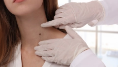 LEKARKA UPOZORILA NA ZABRINJAVAJUĆE REZULTATE, JEDNA STVAR JE KLJUČNA ZA SPREČAVANJE OBOLJENJA U ovom delu Srbije zabeleženo najviše promena na koži