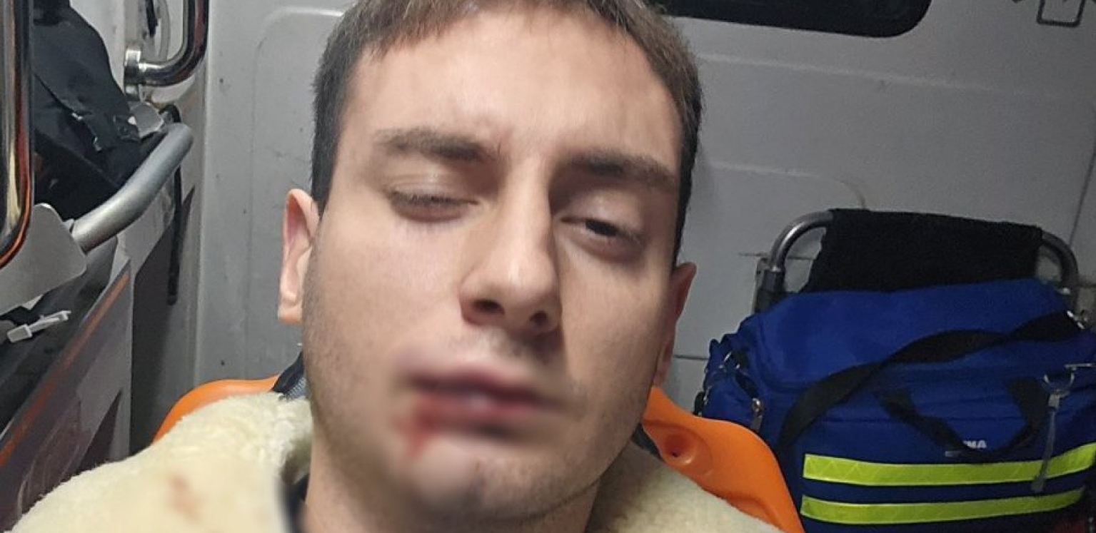 SKANDALOZAN NAPAD NA POLITIČKOG ANALITIČARA! Pretučen Veljko Jovanović, pretili mu i pred policijom: "Gde ti je sad tvoj Vučić i tvoja država?"
