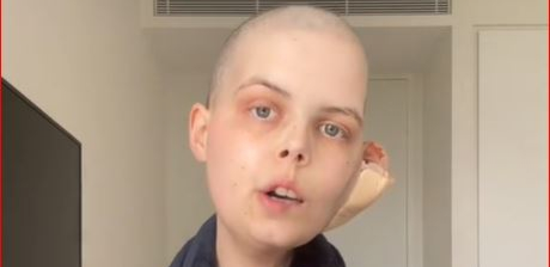 UMRLA POZNATA INFLUENSERKA (24) Bolovala od retkog oblika karcinoma