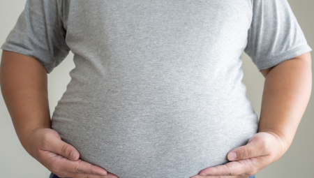 LJUDI, JEL MOGUĆE OVO? Lekari godinama tvrdili da je gojazan, a onda su otkrili da u stomaku ima nešto zastrašujuće!