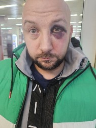 HOROR U KRALJEVU! Funkcioner SNS brutalno prebijen!