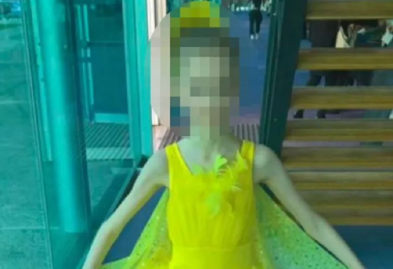 RODITELJI GODINAMA IZGLADNJIVALI ĆERKU BALERINU, DEVOJKA NA IVICI SMRTI! Sa 17 godina izgledala kao da ima 9, nije imala ni 30 kila