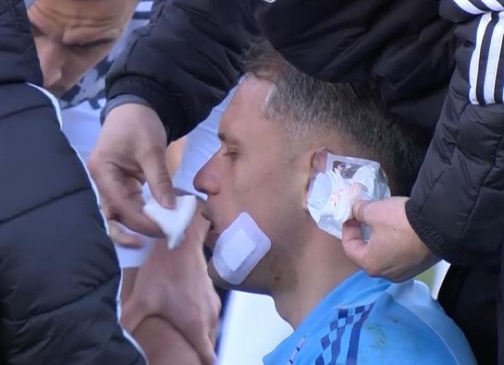 DIVLJAČKI START U DERBIJU HRVATSKE Fudbaler Dinama umalo teško povredio golmana Hajduka, ovako nešto nije za svačiji stomak (VIDEO)