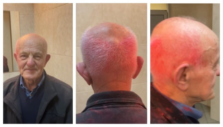 JOŠ JEDAN ZLOČIN AKTIVISTA BLOKADERA U SMEDEREVU! Napadnut deka, pogledajte šta su mu uradili (VIDEO)