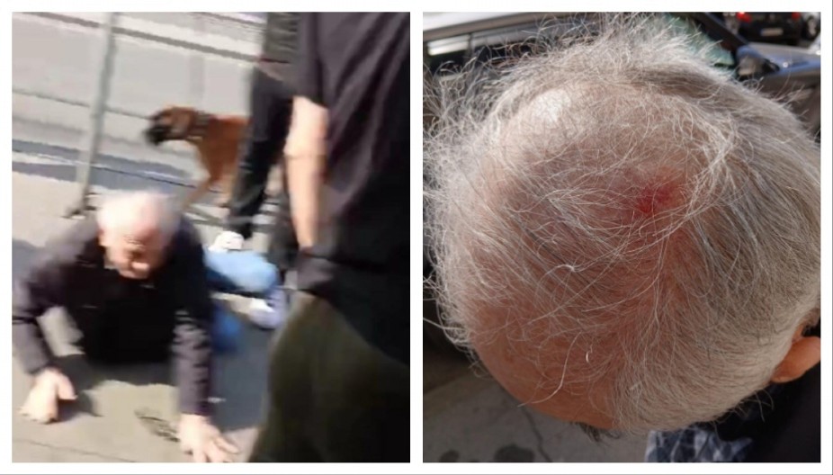 JEZIVE SLIKE TERORA, NJEGA SU NAPALI PRIPADNICI OPOZICIJE Čoveku pocepana glava, leži na podu (FOTO)