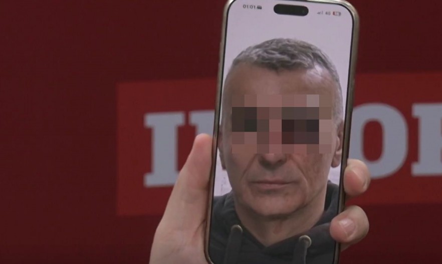 OVO JE POVREĐENI POLICAJAC ISPRED RTS! Boljševički plenumaši udarili su ga bokserom u oko!  (FOTO)