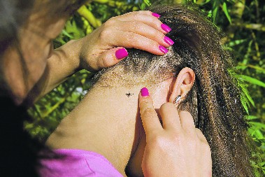 KRPELJI VREBAJU IZ TRAVE Počinje im sezona, ako ih ne uklonite na vreme, u problemu ste, ovo su simptomi