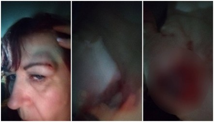 ZAMISLITE DA JE ONA VAŠA MAJKA! Koliko su nisko pali govori i to što su napali žene, znaju samo za nasilje!