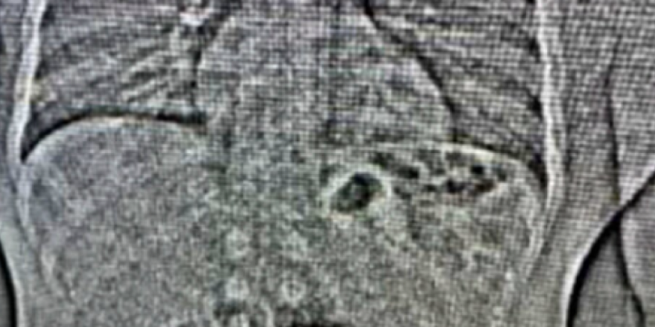 LOPOV PROGUTAO PLEN VREDAN 740.000 EVRA! Bio u njemu više od 10 dana! (FOTO)