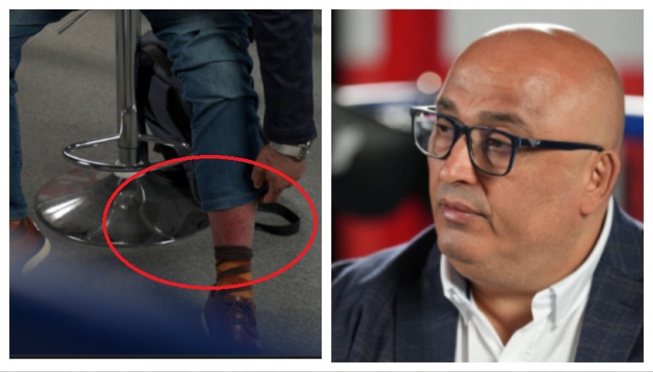 SPUŠTA MI SE OTOK, TEŠKO HODAM Dekan Patrik Drid nam je pokazao rane posle napada: "Ovo su posledice napada rulje"