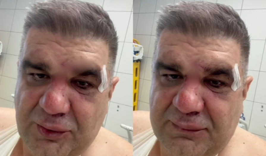 "SPREMAM SE ZA OPERACIJU, RUKA MI JE POLOMLJENA NA TRI MESTA" Prvo oglašavanje Saše Mirkovića nakon što je napadnut (VIDEO)