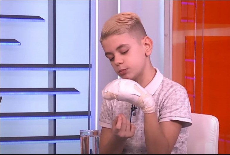 SEĆATE LI SE KONSTANTINA KOJEM JE  EKSPLODIRALA PETARDA U RUCI Lekari su mu amputirali dva prsta, a evo čime se ovaj dečak sada bavi