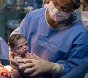 FOTOGRAFIJA KOJA JE ŠOKIRALA MILIONE ''Ljuta'' beba već na rođenju postala zvezda instagrama, a evo kako izgleda danas!