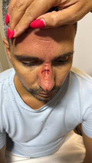 PALA KRV U BAČKOJ PALANCI Nasilni blokaderi gađali Velibora Eraka kamenicama! (FOTO)