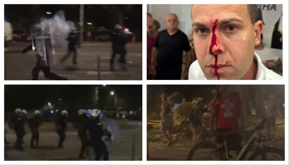 TOTALNA ESKALACIJA BLOKADERSKOG LUDILA! Pala krv, ima povređenih u njihovom divljaštvu! LETE KAMENICE, RADE MOTKE I BAKLJE