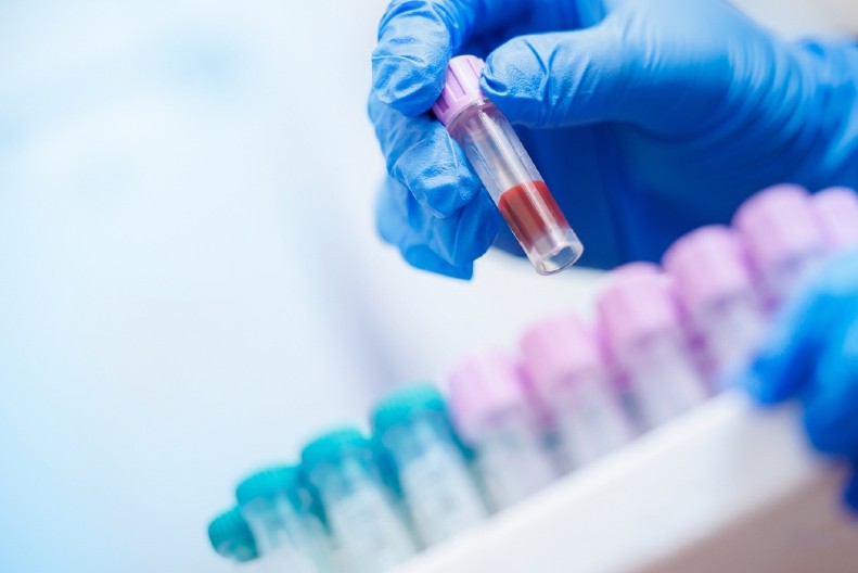 SVAKI DRUGI BOLUJE, A NE ZNA! Tihi ubica hara Srbijom, bolest ubija 6,7 miliona ljudi godišnje – a širi se brže nego ikad!