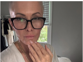 ZBOG BOLESTI JE SAMA OBRIJALA SVOJU GLAVU  Sada se javno obratila svima - ovu poruku morate da pročitate