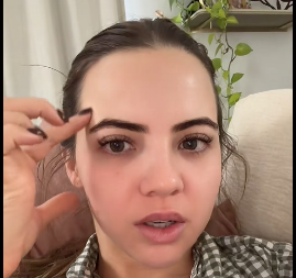 STRAŠNE POSLEDICE BOTOKSA  Devojka pokazala šta joj se desilo nakon tretmana - "paraliza lica nije ono najgore!"