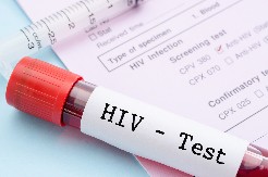 ZA GODINU DANA U SRBIJI REGISTROVANO 109 NOVIH SLUČAJEVA HIV-A  Batut objavio istraživanje povodom Svetskog dana borbe protiv AIDS-A